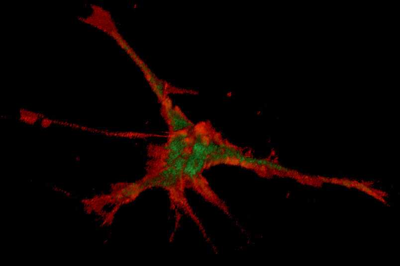 Biochemie - Nerven magnetisch die Wachstumsrichtung zeigen 