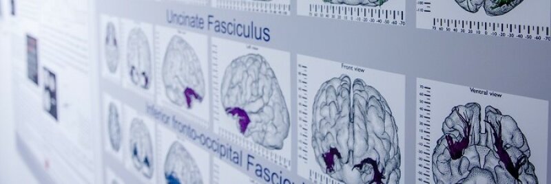 Eine Darstellung von Gehirnscans, die verschiedene Muster und Strukturen zeigen.